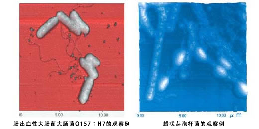 O157型大肠杆菌的显微镜观察